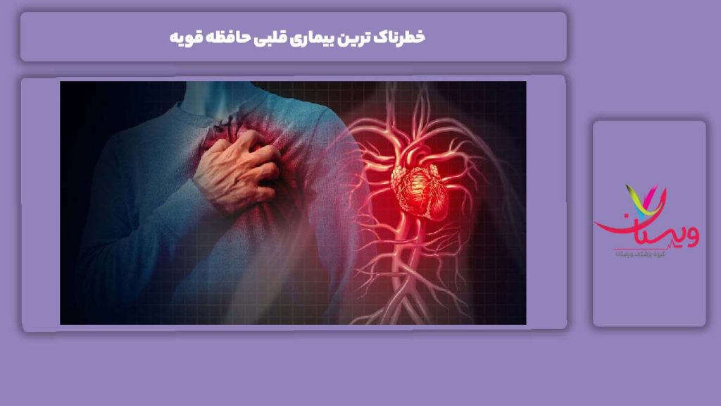 ربط حافظه و بیماریهای قلبی خطرناک ترین بیماری قلبی حافظه قویه