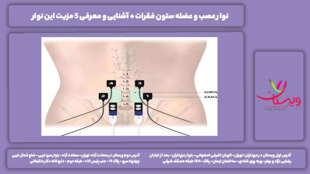 نوار عصب و عضله ستون فقرات