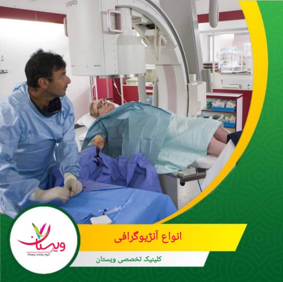 روشهای نوین مانند CT و MRI آنژیوگرافی امروزه بهدلیل دقت بالا و کمتهاجمی بودن، محبوبیت بیشتری دارند. انواع آنژیوگرافی