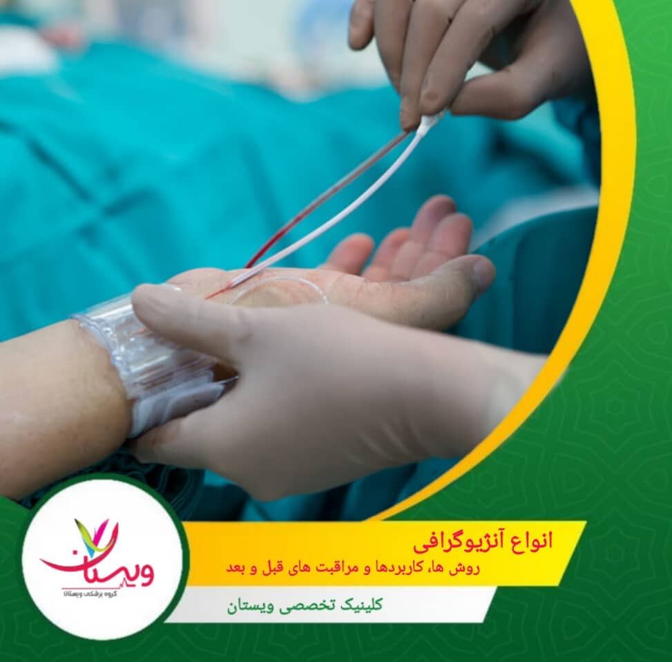 انواع آنژیوگرافی: روشها، کاربردها و مراقبتهای قبل و بعد