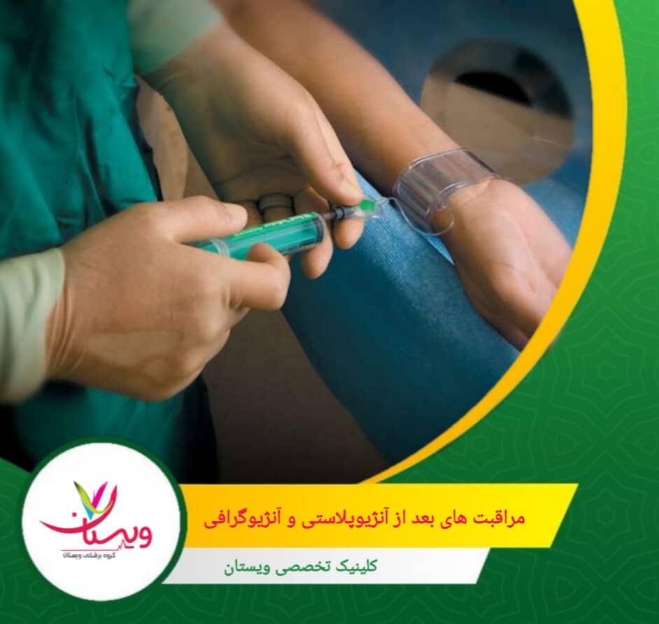 بعد از آنژیوگرافی در صورت خونریزی شدید یا درد غیرطبیعی فوراً به پزشک مراجعه کنید مراقبت های بعد از آنژیوپلاستی و آنژیوگرافی