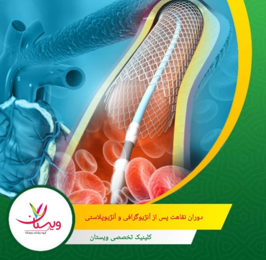 پس از آنژیوپلاستی، بیمار معمولاً یک شب بستری میشود و مراقبت از رگ درمانشده اهمیت ویژه دارد. دوران نقاهت پس از آنژیوگرافی و آنژیوپلاستی