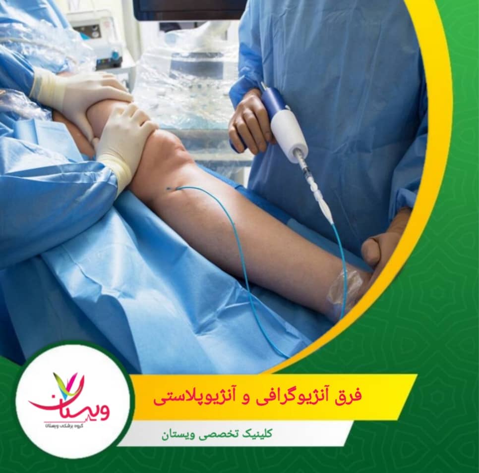 آنژیوگرافی حدود ۳۰ دقیقه تا ۱ ساعت طول می کشد. فرق آنژیوگرافی و آنژیوپلاستی