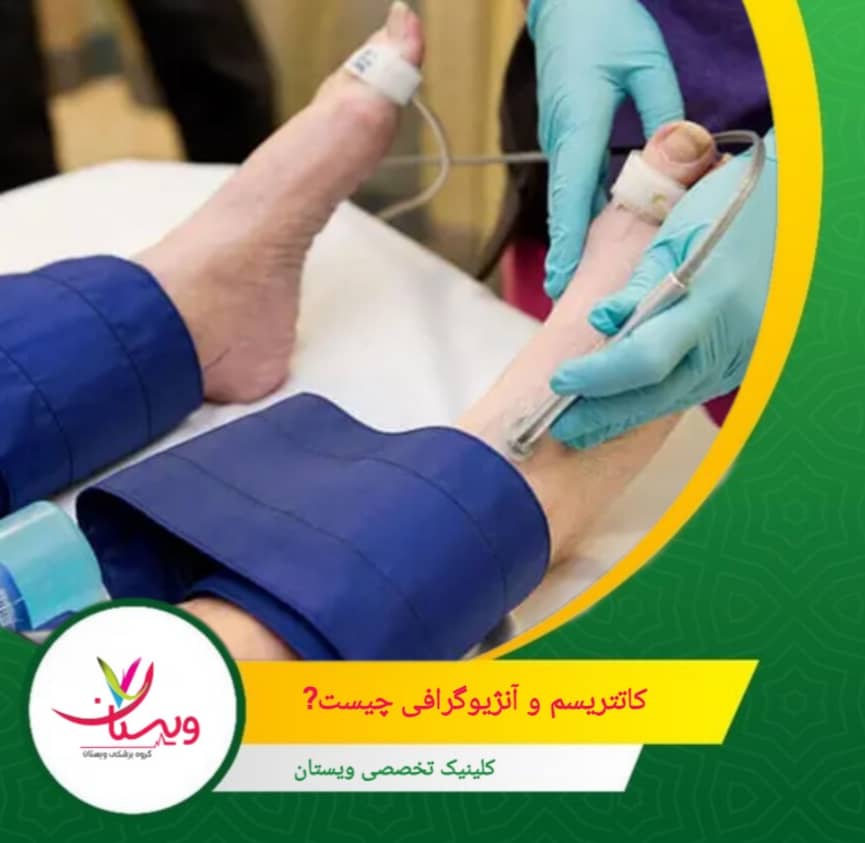 در آنژیوگرافی، ماده حاجب (رنگ مخصوص تصویربرداری) از طریق همین کاتتر به داخل عروق تزریق میشود و با استفاده از اشعه ایکس، مسیر و ساختار رگهای قلبی بهصورت دقیق روی تصویر قابل مشاهده است. کاتتریسم و آنژیوگرافی چیست؟