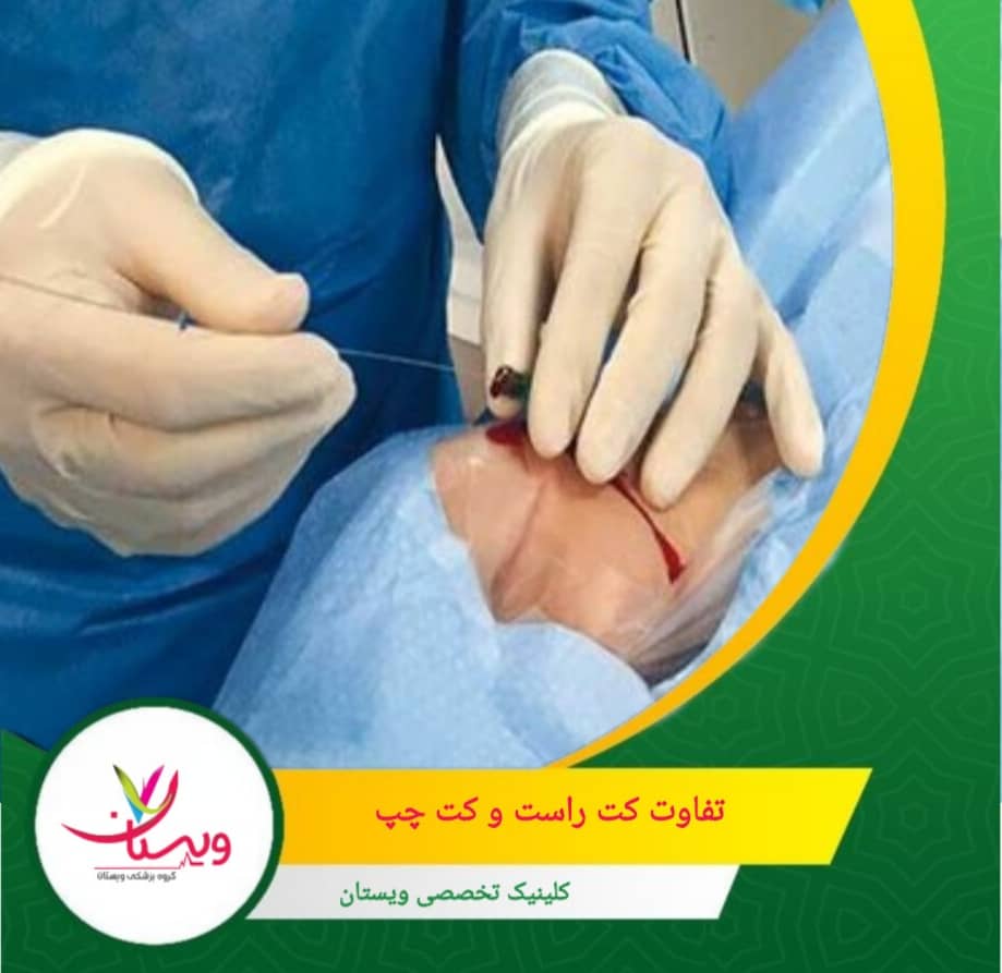 در کت راست مسیر وریدی ایمنتر است و احتمال خونریزی یا آسیب شریانی کمتر دارد تفاوت کت راست و کت چپ