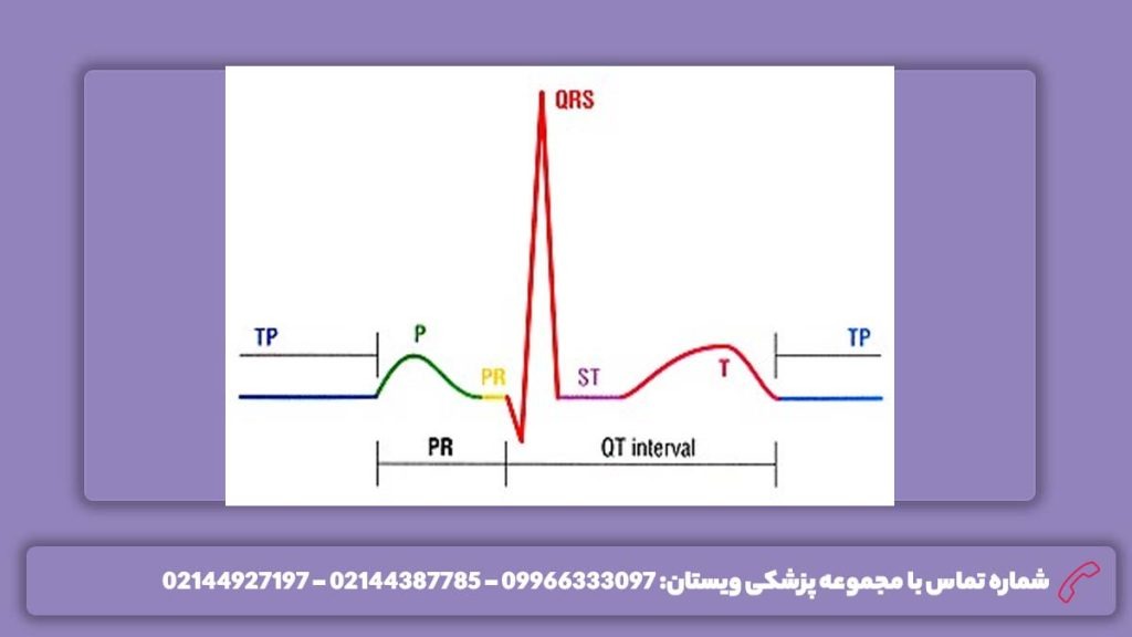 خواندن نوار قلب به صورت ساده تفسیر نوار قلب آنلاین و ساده
