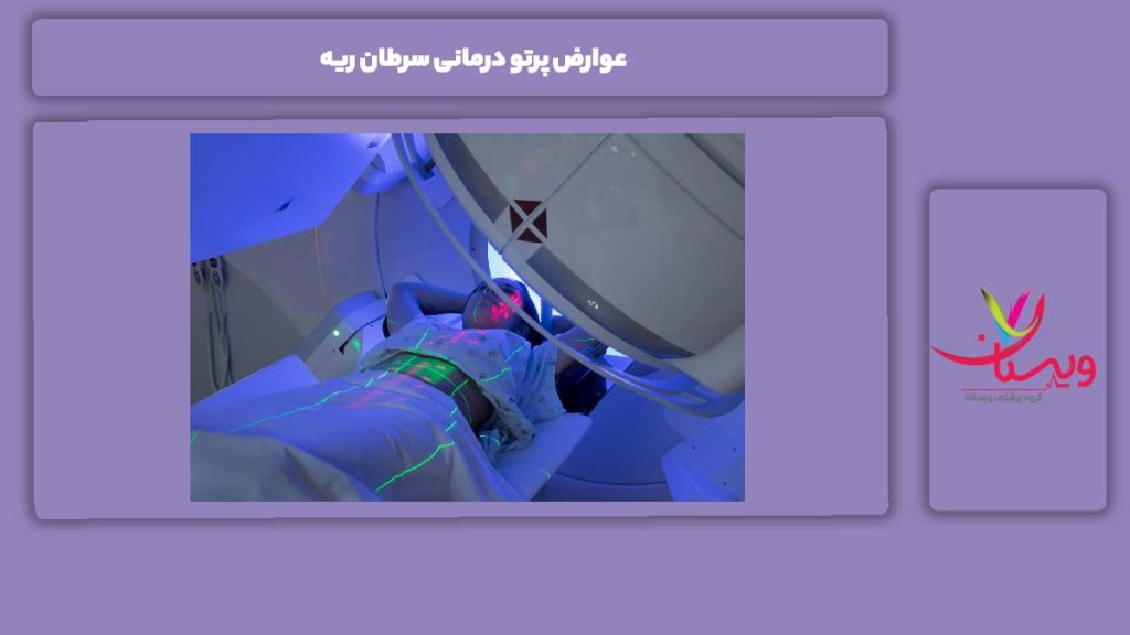 روشکاهش عوارض عوارض پرتو درمانی سرطان ریه