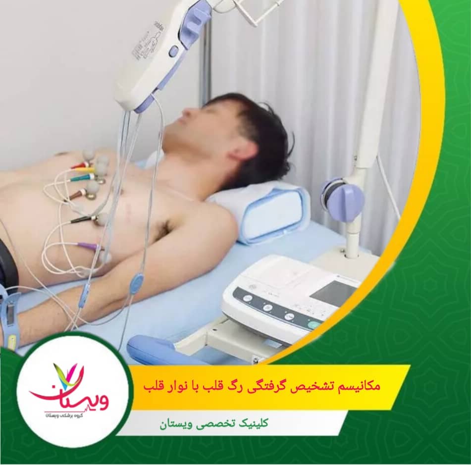 گرفتگی عروق کرونر (CAD) معمولاً به دلیل رسوب چربی و کلسترول (پلاک) رخ میدهد. وقتی این پلاکها مسیر خون را تنگ میکنند، عضله قلب دچار "ایسکمی" یا کمخونی میشود. مکانیسم تشخیص گرفتگی رگ قلب با نوار قلب