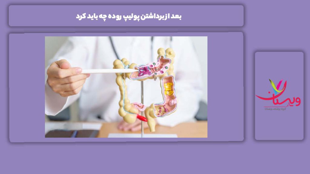 موارد مراقبتی بعد از برداشتن پولیپ روده چه باید کرد