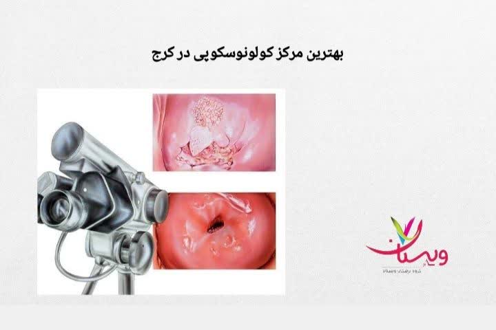 توضیح درباره ویژگیهای یک مرکز قابل اعتماد بهترین مرکز کولونوسکوپی در کرج