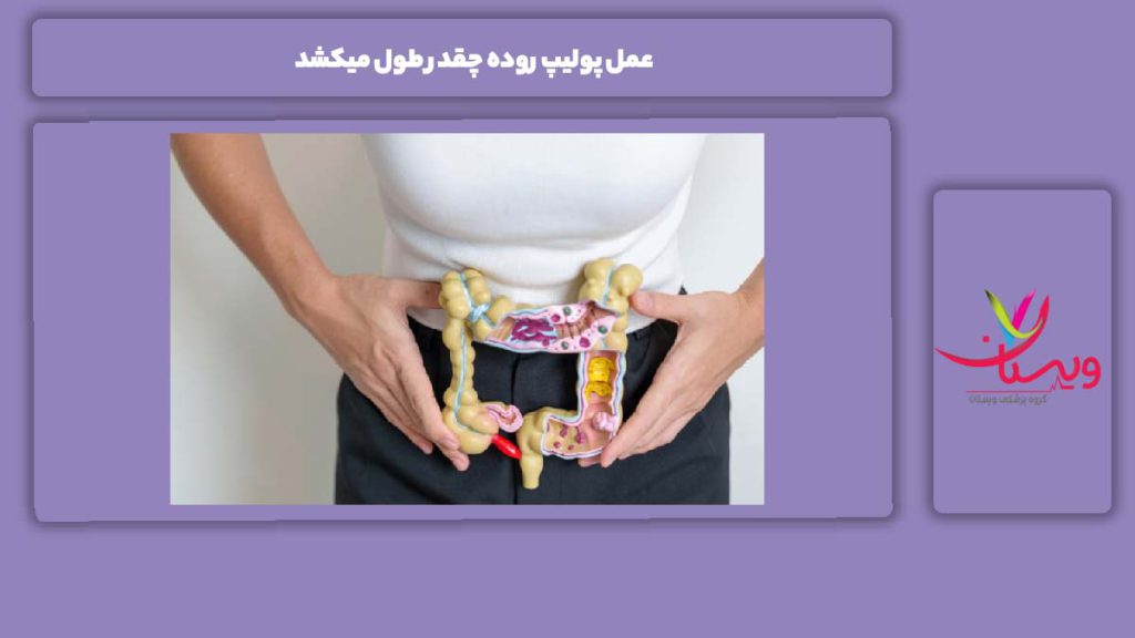 نکات مهم درباره طول عمل عمل پولیپ روده چقدر طول میکشد