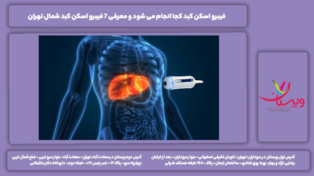 فیبرو اسکن کبد کجا انجام می شود
