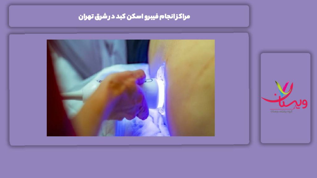 مریتهای مراکز شرق تهران فیبرو اسکن کبد کجا انجام می شود