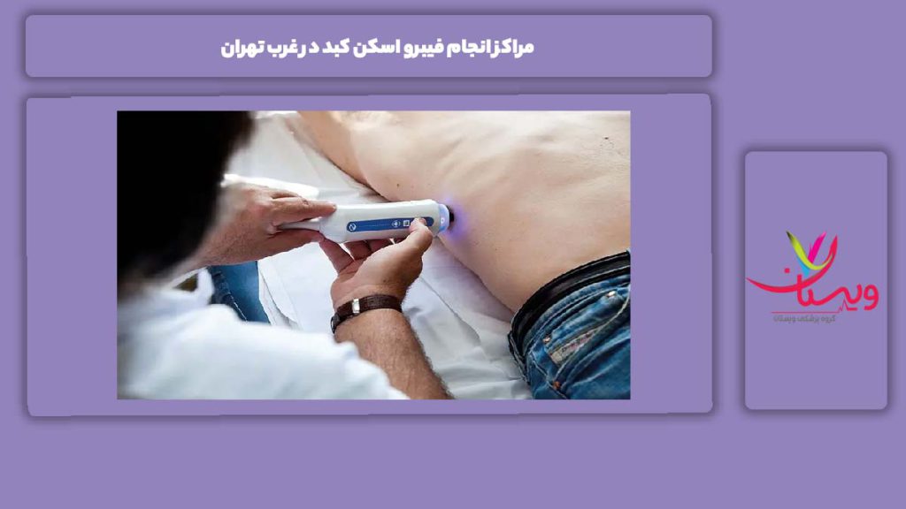 ویژگیهای مراکز غرب مراکز انجام فیبرو اسکن کبد در غرب تهران
