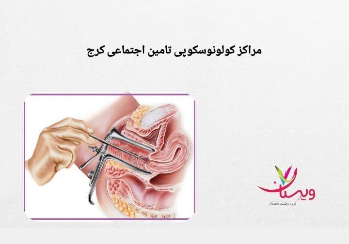مراکزی که خدمات کولونوسکوپی را با دفترچه انجام میدهند مراکز کولونوسکوپی در کرج