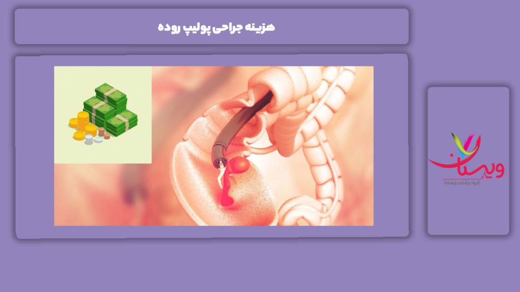 عوامل مؤثر بر هزینه هزینه جراحی پولیپ روده