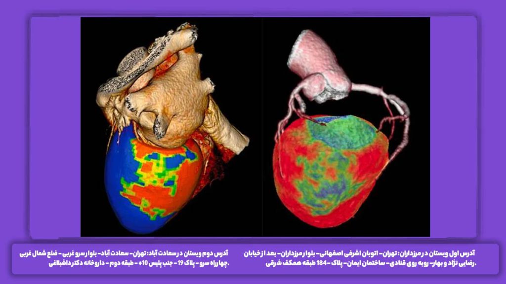آیا اسکن قلب خطرناک است؟