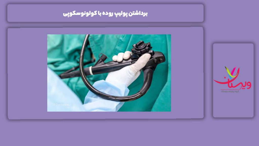 مزایای برداشتن پولیپ با کولونوسکوپی برداشتن پولیپ روده با کولونوسکوپی