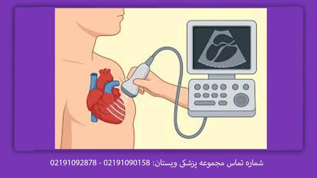 تفسیر اکو مری قلب تفسیر اکو مری قلب چگونه است؟