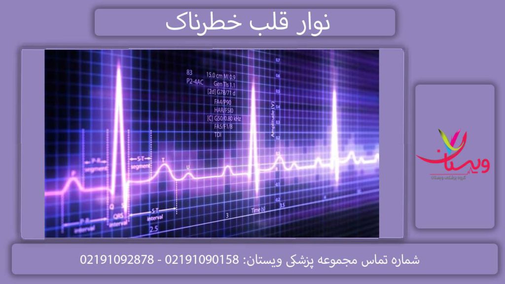 نوار قلب های خطرناک نشانههای نوار قلب خطرناک