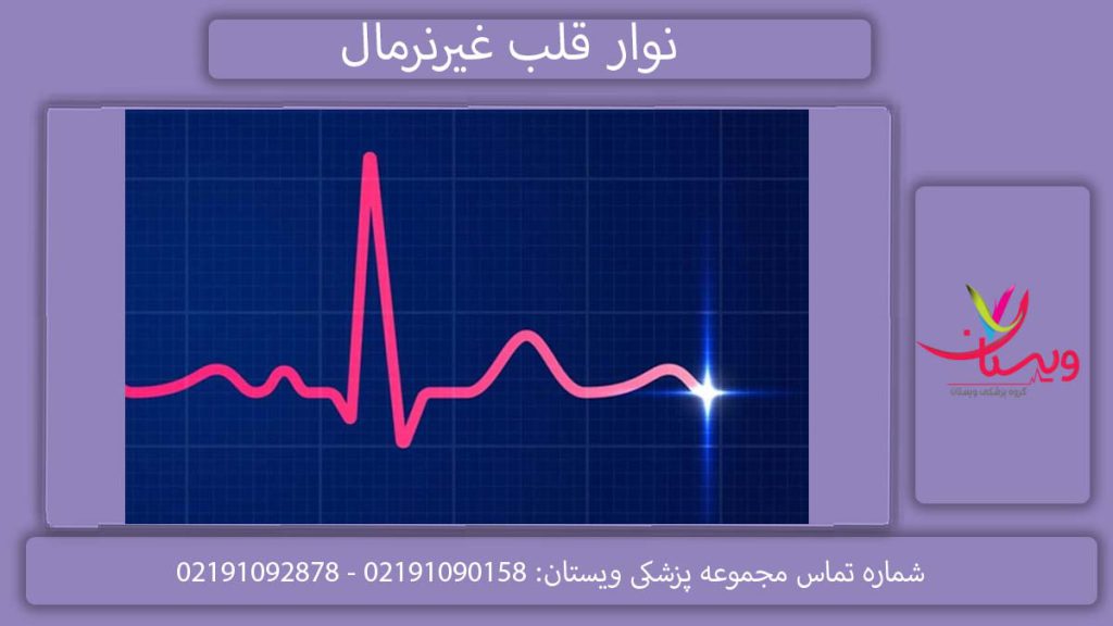 نوار قلب خطرناک