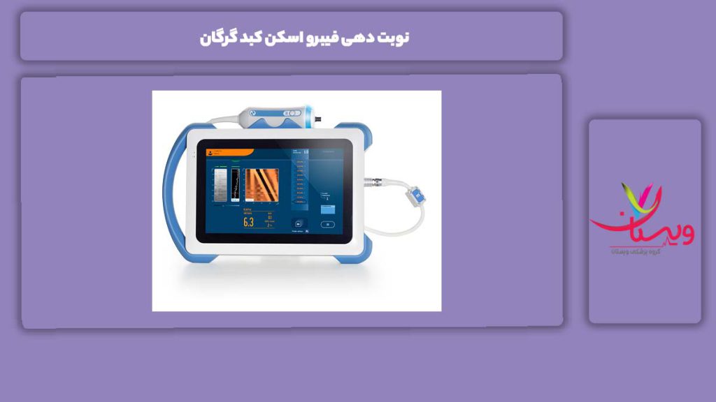 راههای نوبت گرفتن در گرگان نوبت دهی فیبرو اسکن کبد گرگان