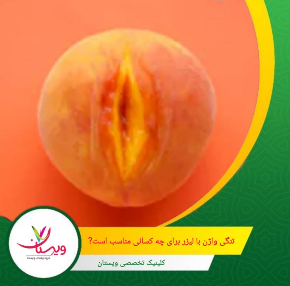 در مقابل، در موارد شلشدگی شدید یا افتادگی پیشرفته، ممکن است پزشک روشهای ترکیبی یا جراحی را پیشنهاد دهد که طبیعتاً هزینه متفاوتی خواهند داشت. تنگی واژن با لیزر برای چه کسانی مناسب است؟