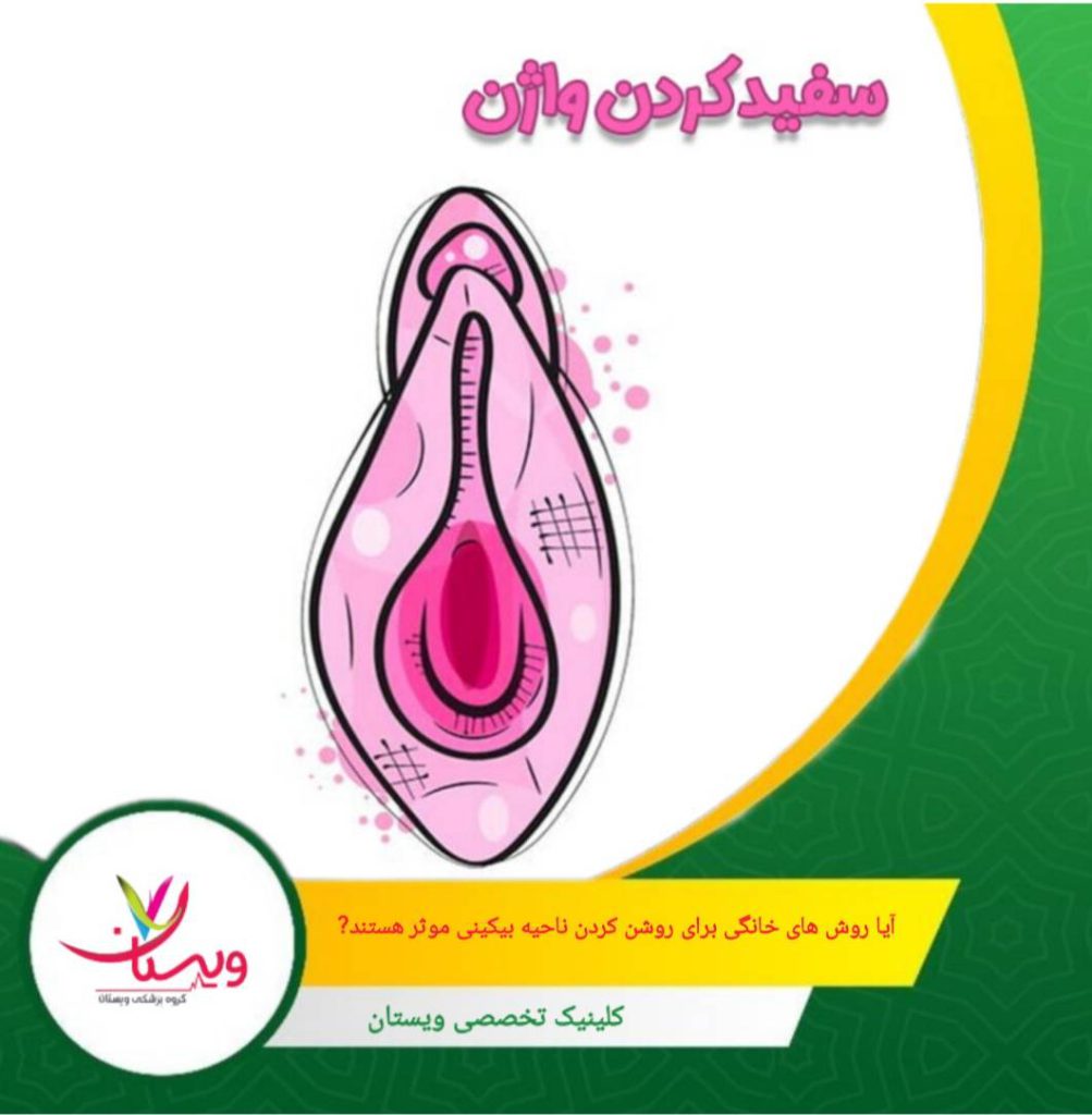 روش های خانگی برای روشن کردن ناحیه بیکینی نیاز به صبر و استمرار دارند. آیا روشهای خانگی برای روشن کردن ناحیه بیکینی مؤثر هستند؟