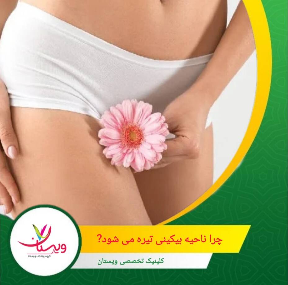 روشن کردن ناحیه بیکینی بدون بررسی زمینه هورمونی، معمولاً موقتی و کماثر است. چرا ناحیه بیکینی تیره میشود؟