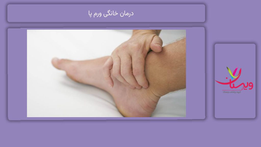 روشهای موثر خانگی درمان خانگی ورم پا