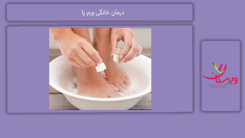 درمانهای خانگی بسیار مؤثر درمان خانگی ورم پا