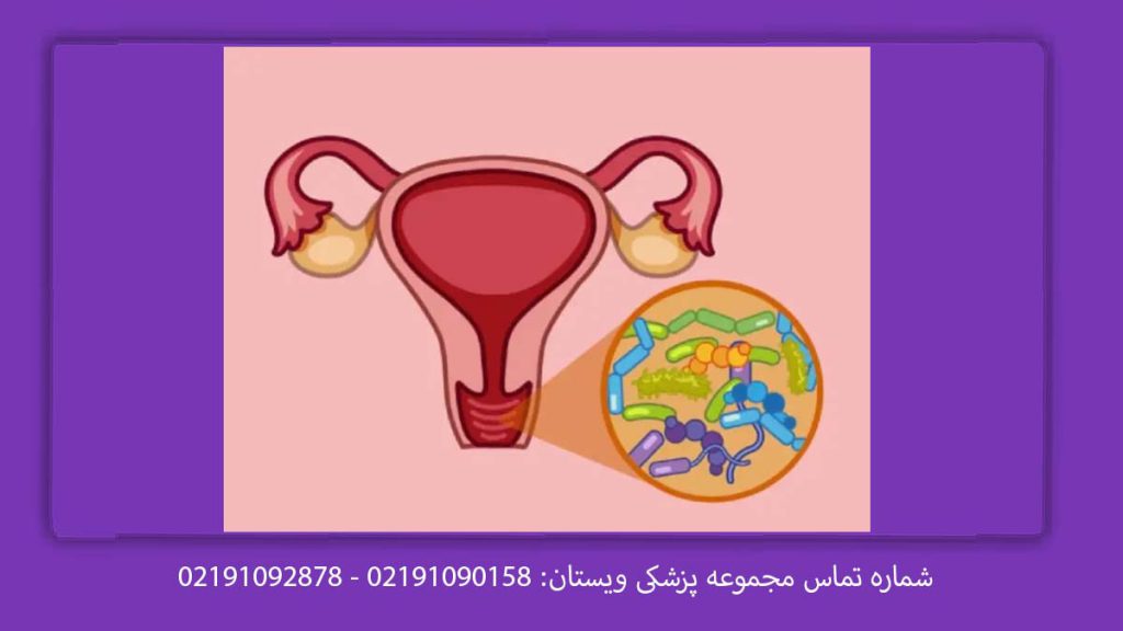درمان عفونت واژن در دختران درمان قطعی عفونت واژن در دختران