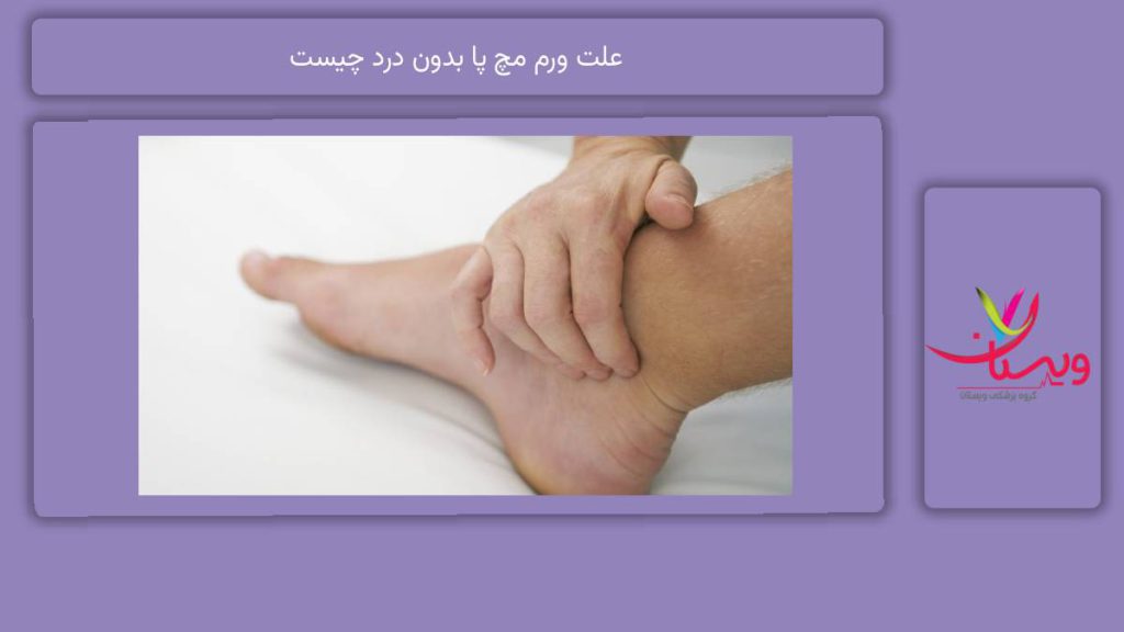 علت رایج ورم بدون درد علت ورم مچ پا بدون درد چیست