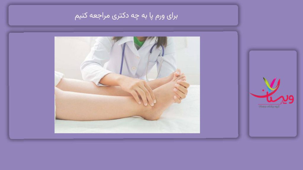 دکترهای مرتبط با ورم پا برای ورم پا به چه دکتری مراجعه کنیم