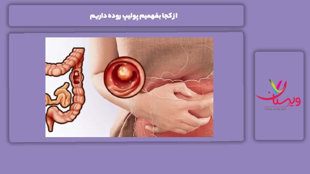 علائم وجود داشتن پولیپ روده از کجا بفهمیم پولیپ روده داریم
