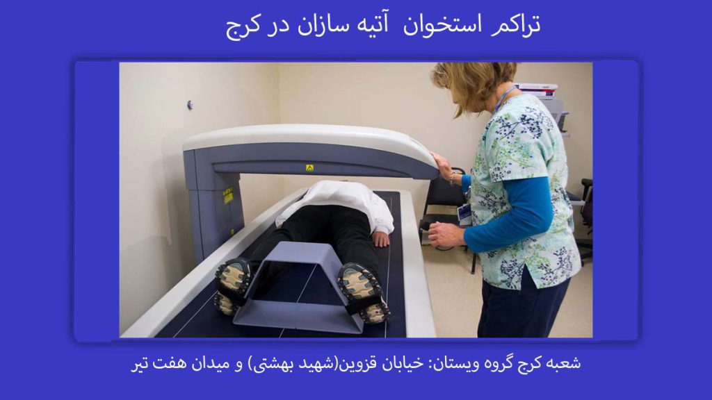 تراکم استخوان آتیه سازان در کرج مراکز سنجش تراکم استخوان طرف قرارداد بیمه آتیه سازان حافظ در کرج