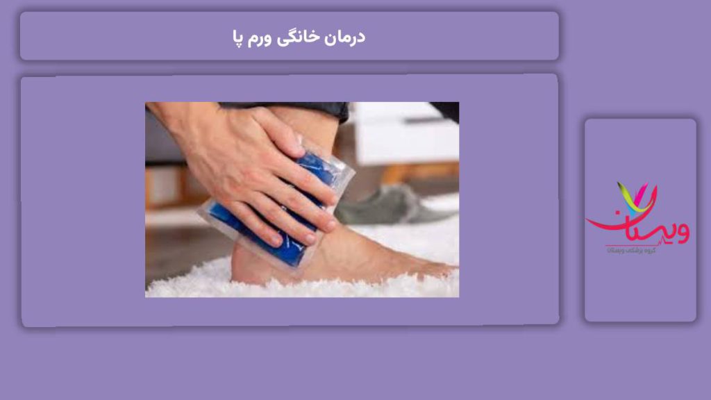 خوب کردن ورم پا در منزل درمان خانگی ورم پا
