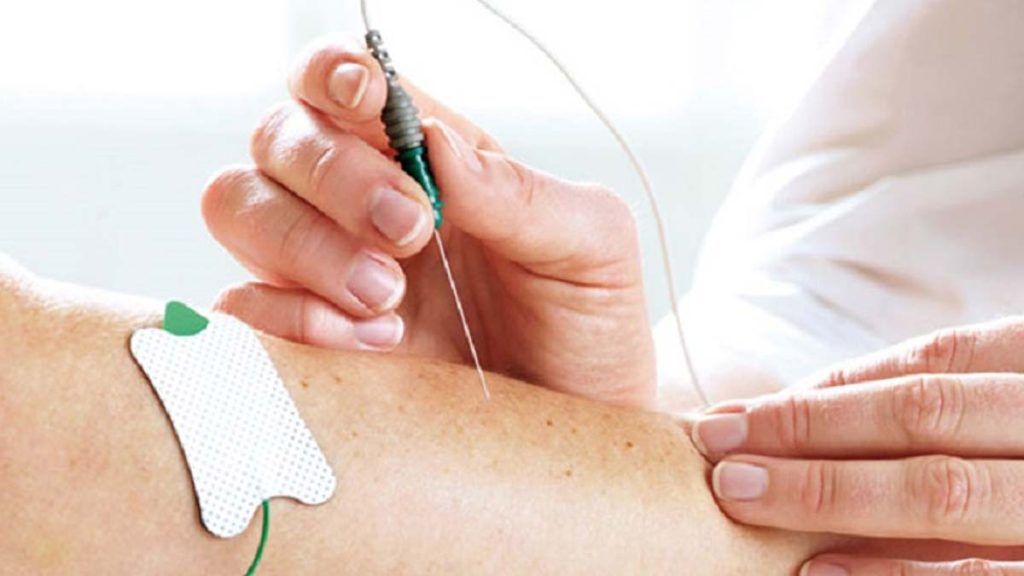 emg مراکز دولتی نوار عصب عضله دولتی تهران